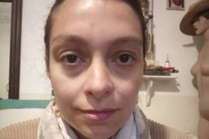 Córdoba: una mujer inició una demanda contra AstraZeneca tras quedar con una discapacidad del 75,6%